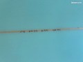 SurfSystem/ST949-123386-57a5a20c94e184027f945aa8ac822b33297fb067